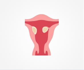 Fibroids Sepcialist in India - Dr Rishma Pai